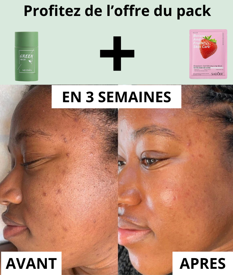 Masque thé vert -Nettoie, Purifie et Réduit les Points Noirs !