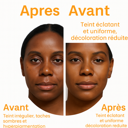 Savon au curcuma