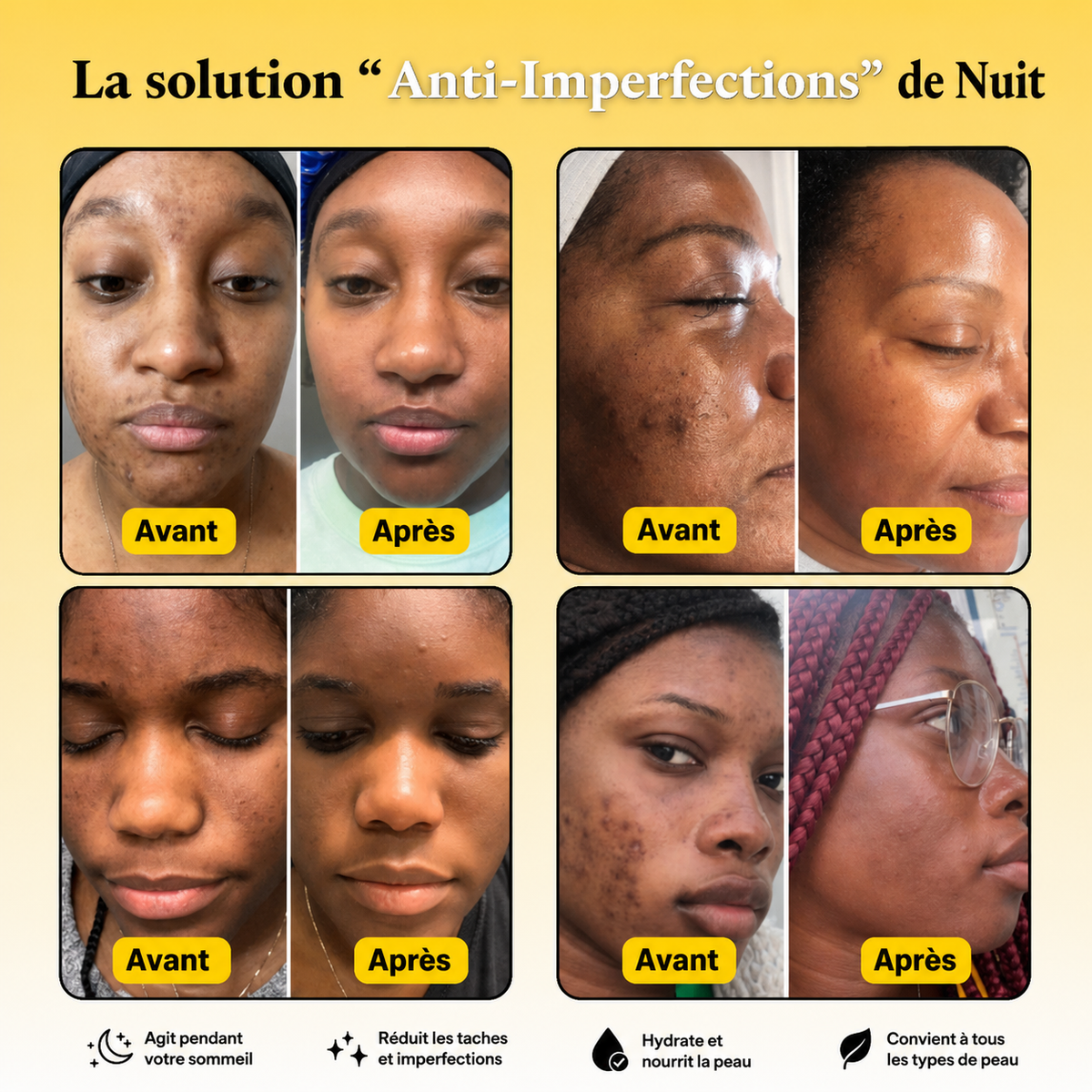 2 Masque Visage de nuit au curcuma l Anti-imperfection